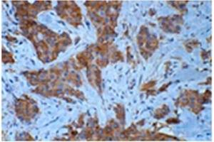 Immunohistochemistry (IHC) image for anti-Tubulin, beta 3 (TUBB3) antibody (ABIN1109374)