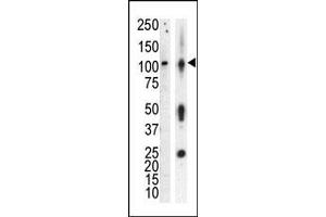 Western blot analysis of anti-PKCnu Pab in lysate of HL60 cells stimulated with PMA (lane A) and mouse brain tissue lysate (lane B). (PRKD3 anticorps  (Middle Region))