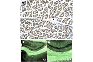 Immunohistochemical staining (Formalin-fixed paraffin-embedded sections) of human muscle (A) and rat brain (B, C) with GABRD polyclonal antibody . (GABRD anticorps  (N-Term))