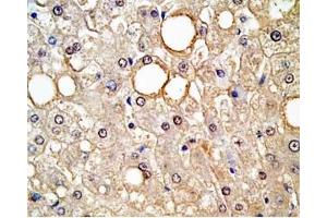 Human liver tissue was stained by rabbit Anti-ABCB6 Protein(260-301) (H) antibody