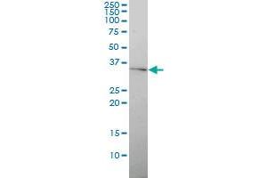 GJB4 monoclonal antibody (M01), clone 1E3-1C12 Western Blot analysis of GJB4 expression in Hela .