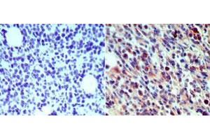 Langerin Immunohistochemistry.
