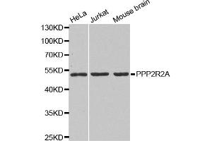 Western blot analysis of extracts of various cell lines, using PPP2R2A antibody. (PPP2R2A anticorps)