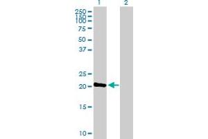 Western Blot analysis of C1orf57 expression in transfected 293T cell line by C1orf57 MaxPab polyclonal antibody. (C1orf57 anticorps  (AA 1-190))