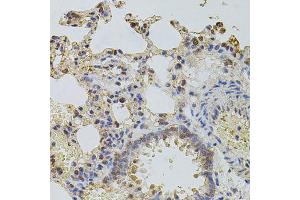 Immunohistochemistry of paraffin-embedded rat lung using PLK4 antibody (ABIN6003595) at dilution of 1/100 (40x lens). (PLK4 anticorps)
