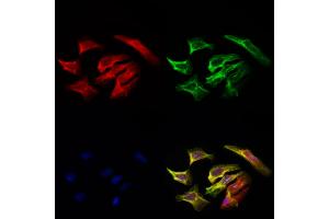 ABIN6257176 and ABIN6275120 staining Hela cells by IF/ICC.