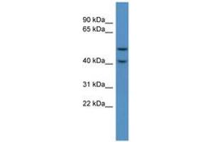 Image no. 1 for anti-Fukutin Related Protein (FKRP) (C-Term) antibody (ABIN6746249) (FKRP anticorps  (C-Term))