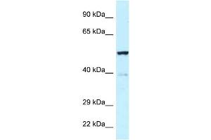 WB Suggested Anti-Trp63 Antibody   Titration: 1. (TRP63 anticorps  (Middle Region))
