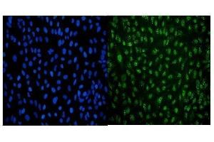 IF analysis of LSM8 using anti-LSM8 antibody (ABIN7599578). (NAA38 anticorps  (AA 1-96))