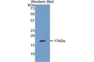 Detection of Recombinant EPN1, Human using Polyclonal Antibody to Epsin 1 (EPN1) (Epsin 1 anticorps  (AA 279-437))