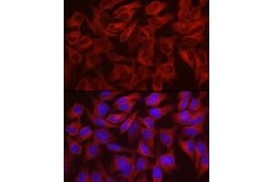 Immunofluorescence analysis of HeLa cells using WISP2 Rabbit pAb (ABIN6128928, ABIN6150226, ABIN6150228 and ABIN6216206) at dilution of 1:100 (40x lens). (WISP2 anticorps  (AA 151-250))