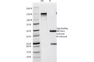 SDS-PAGE Analysis Purified gp100 / Melanosome Mouse Monoclonal Antibody (NKI-beteb). (Melanoma gp100 anticorps)