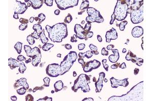 IHC analysis of Aromatase using anti-Aromatase antibody (ABIN6719449).