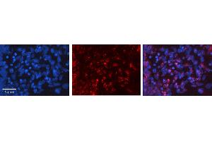 Rabbit Anti-FGF2 Antibody   Formalin Fixed Paraffin Embedded Tissue: Human Ovary Tissue Observed Staining: Nucleus Primary Antibody Concentration: 1:600 Other Working Concentrations: N/A Secondary Antibody: Donkey anti-Rabbit-Cy3 Secondary Antibody Concentration: 1:200 Magnification: 20X Exposure Time: 0. (FGF2 anticorps  (Middle Region))