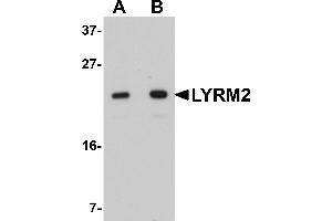 Western Blotting (WB) image for anti-LYR Motif Containing 2 (LYRM2) (C-Term) antibody (ABIN1030499) (LYRM2 anticorps  (C-Term))