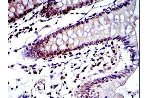 Immunohistochemical analysis of paraffin-embedded colon tissues using PSMB8 mouse mAb with DAB staining.