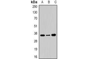 Western blot analysis of WDR5 expression in 22RV1 (A), BT474 (B), Hela (C) whole cell lysates. (WDR5 anticorps)