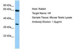 Image no. 1 for anti-Hepatic Leukemia Factor (HLF) (N-Term) antibody (ABIN6749814) (HLF anticorps  (N-Term))