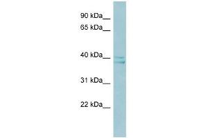 RAD51AP1 antibody used at 1 ug/ml to detect target protein. (RAD51AP1 anticorps  (Middle Region))
