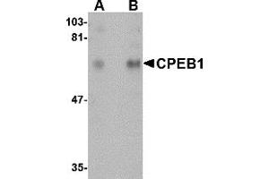 Western Blotting (WB) image for anti-Cytoplasmic Polyadenylation Element Binding Protein 1 (CPEB1) (N-Term) antibody (ABIN1031326) (CPEB1 anticorps  (N-Term))
