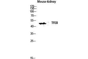 Western Blot (WB) analysis of Mouse Kidney lysis using TFEB antibody. (TFEB anticorps  (N-Term))