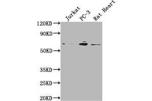 Western Blot Positive WB detected in: Jurkat whole cell lysate, PC-3 whole cell lysate, Rat Heart tissue All lanes: E2F1 antibody at 1:2000 Secondary Goat polyclonal to rabbit IgG at 1/50000 dilution Predicted band size: 47 kDa Observed band size: 60 kDa (Recombinant E2F1 anticorps)