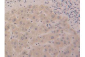 DAB staining on IHC-P; Samples: Human Liver Tissue
