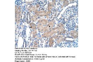 Rabbit Anti-SLA/LP Antibody  Paraffin Embedded Tissue: Human Kidney Cellular Data: Epithelial cells of renal tubule Antibody Concentration: 4. (SLA anticorps  (N-Term))
