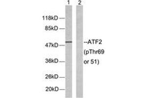 Western blot analysis of extracts from LOVO cells, using ATF2 (Phospho-Thr69 or 51) Antibody. (ATF2 anticorps  (pSer69))