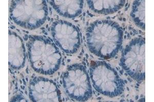 Detection of NE in Human Rectum Tissue using Polyclonal Antibody to Neutrophil Elastase (NE)