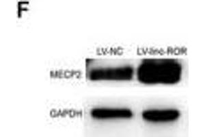 linc-ROR promoted cell proliferation, migration, and invasion of breast cancer through linc-ROR/miR-194-3p/MECP2 regulatory axis. (MECP2 anticorps  (AA 1-100))