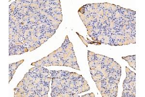 ABIN7094803 and ABIN7098854 at 1/100 staining Rat stomach tissue by IHC-P. (Asporin anticorps  (C-Term))