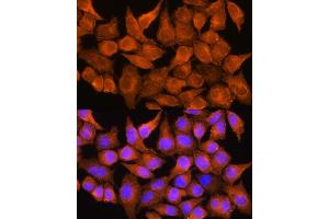 Immunofluorescence analysis of HeLa cells using  Rabbit pAb (ABIN1678678, ABIN3017841, ABIN3017842 and ABIN6220287) at dilution of 1:100. (AOX1 anticorps  (AA 340-590))