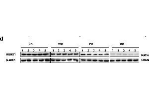 Identification of RUNX1 as an apoptosis transcription factor and an independent prognostic factor in NB tissue and cell lines.