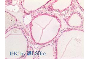 ABIN6391411 (5µg/ml) staining of paraffin embedded Human Thyroid. (Notch1 anticorps  (AA 171-182))