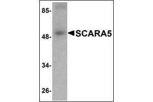 Western blot analysis of SCARA5 in human liver tissue lysate with SCARA5 antibody at 1 μg/ml.