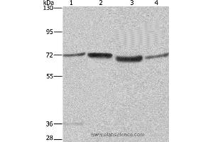 Western blot analysis of A375 and 231 cell, 293T cell and human hepatocellular carcinoma tissue , using SYN1 Polyclonal Antibody at dilution of 1:550 (SYN1 anticorps)