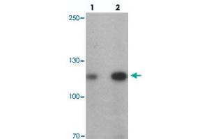 Western blot analysis of ANKRD27 in K-562 cell lysate with ANKRD27 polyclonal antibody  at (lane 1) 1 and (lane 2) 2 ug/mL.