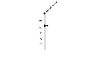 Anti-AGL Antibody (C-term) at 1:8000 dilution + human skeletal muscle lysate Lysates/proteins at 20 μg per lane. (AGL anticorps  (C-Term))