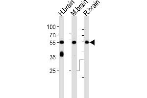 Western blot analysis of lysates from human brain, mouse brain and rat brain tissue lysate (from left to right), using CSIN1 Antibody (G23) (ABIN392664 and ABIN2842162).