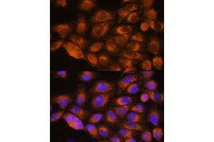 Immunofluorescence analysis of HeLa cells using A antibody (ABIN1678588, ABIN3015506, ABIN3015508 and ABIN6218562) at dilution of 1:100. (alpha 1 Adrenergic Receptor anticorps  (AA 346-475))