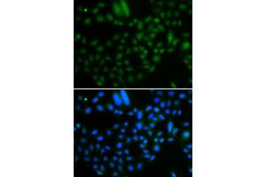 Immunofluorescence analysis of A549 cells using ALKBH8 antibody (ABIN5974297). (ALKBH8 anticorps)
