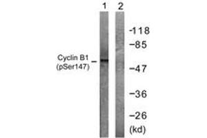 Western blot analysis of extracts from Jurkat cells treated with UV 15', using Cyclin B1 (Phospho-Ser147) Antibody. (Cyclin B1 anticorps  (pSer147))