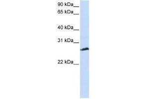 SYCP3 antibody used at 1 ug/ml to detect target protein. (SYCP3 anticorps  (N-Term))
