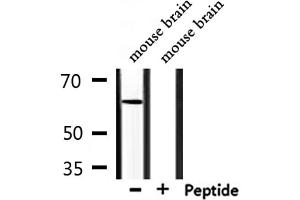 Western blot analysis of extracts from mouse brain, using CERKL Antibody. (CERKL anticorps  (Internal Region))