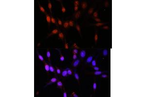 Immunofluorescence analysis of NIH/3T3 cells using KA antibody (ABIN7268768) at dilution of 1:100. (MYST3 anticorps  (AA 800-1000))