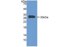 Western blot analysis of recombinant Human TLN.