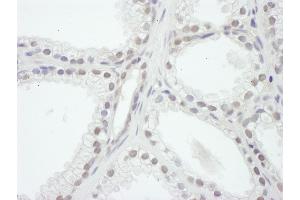 Immunohistochemistry (IHC) image for anti-Nuclear Receptor Coactivator 1 (NCOA1) (AA 600-650) antibody (ABIN7454614)