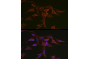 Immunofluorescence analysis of C6 cells using STA Rabbit pAb (ABIN6128540, ABIN6148576, ABIN6148578 and ABIN6223670) at dilution of 1:50 (40x lens). (STAT5A anticorps  (AA 635-794))