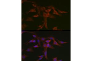 Immunofluorescence analysis of C6 cells using STA Rabbit pAb (ABIN6128540, ABIN6148576, ABIN6148578 and ABIN6223670) at dilution of 1:50 (40x lens). (STAT5A anticorps  (AA 635-794))